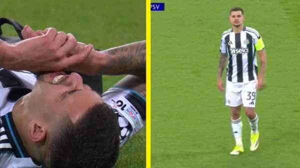 巴西铁腰伤退埋隐患 纽卡魔鬼赛程前再遭打击